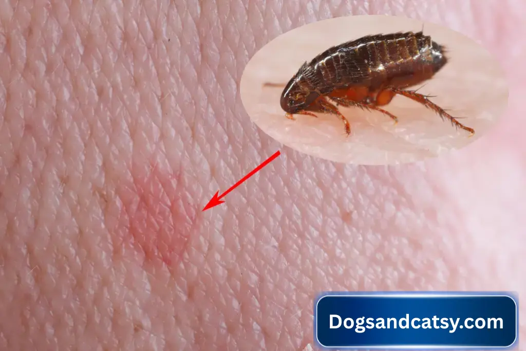 People and pets can get the plague after being bitten by infected fleas or after direct contact with infected animals